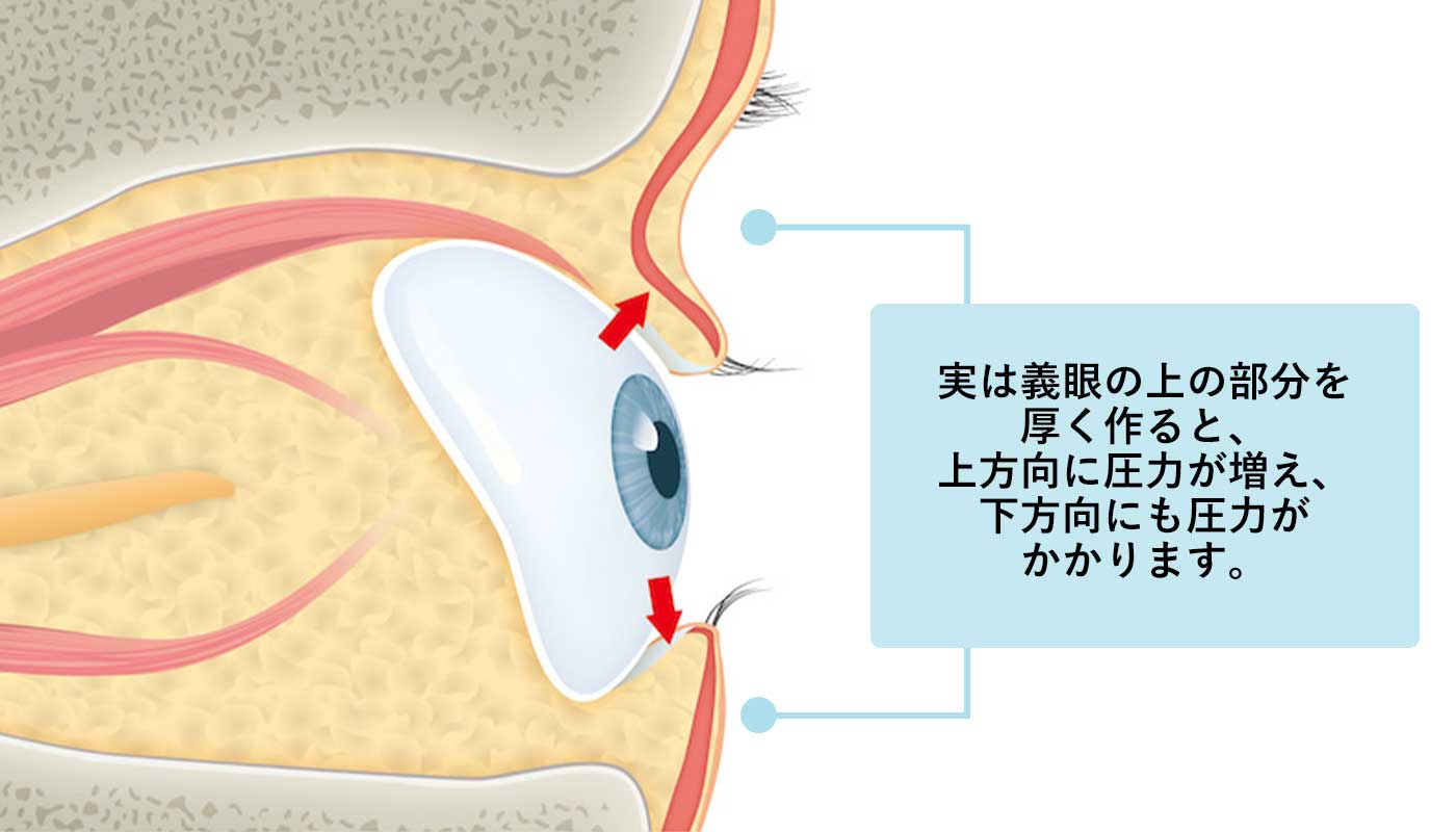 義眼のみ装着
