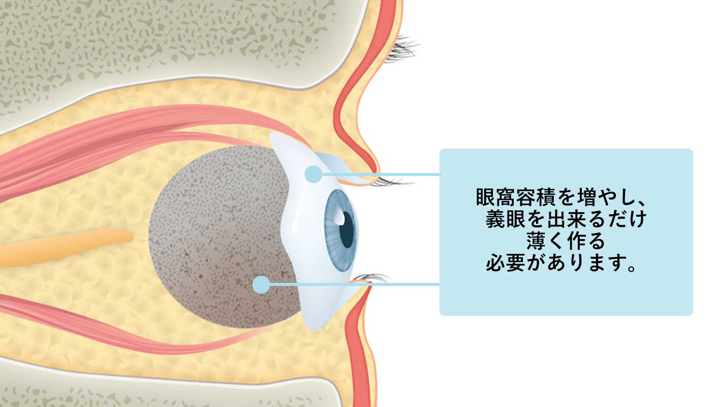 義眼台挿入+義眼装着