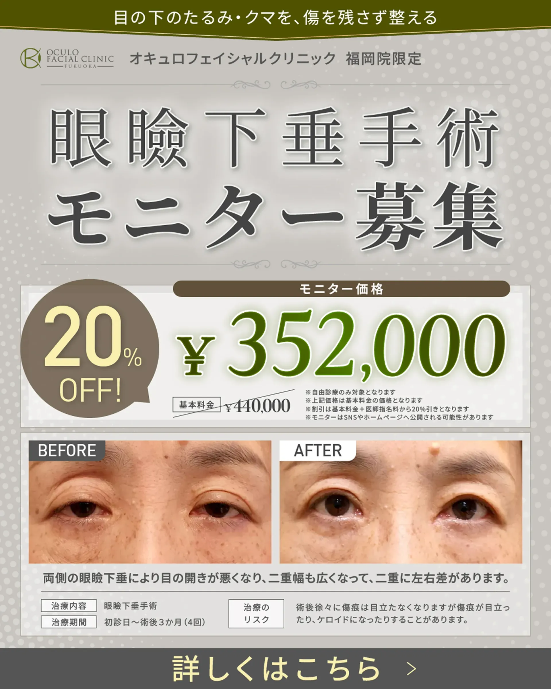 眼瞼下垂