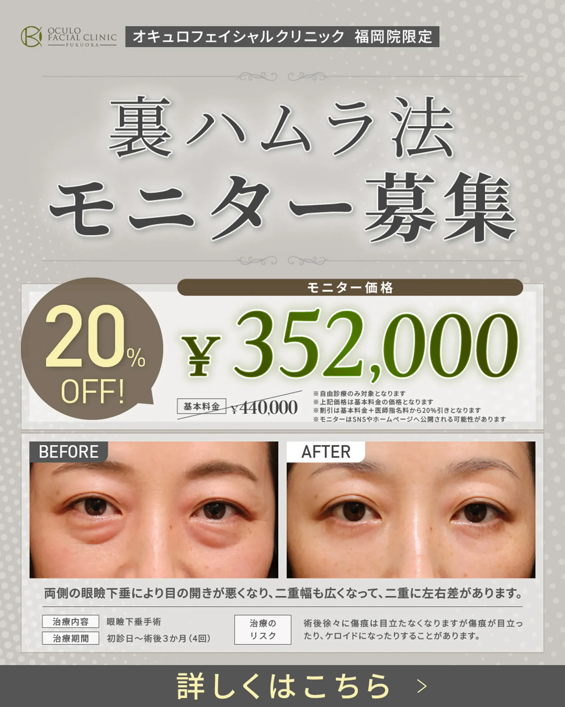 ハムラ法