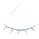切開法（二重整形）