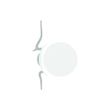 義眼治療